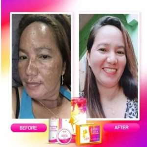 Kit miracle super éclaircissant peeling